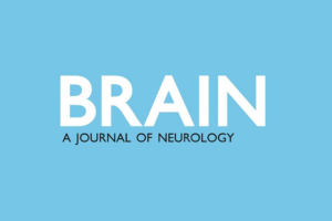 Brain: A Journal of Neurology